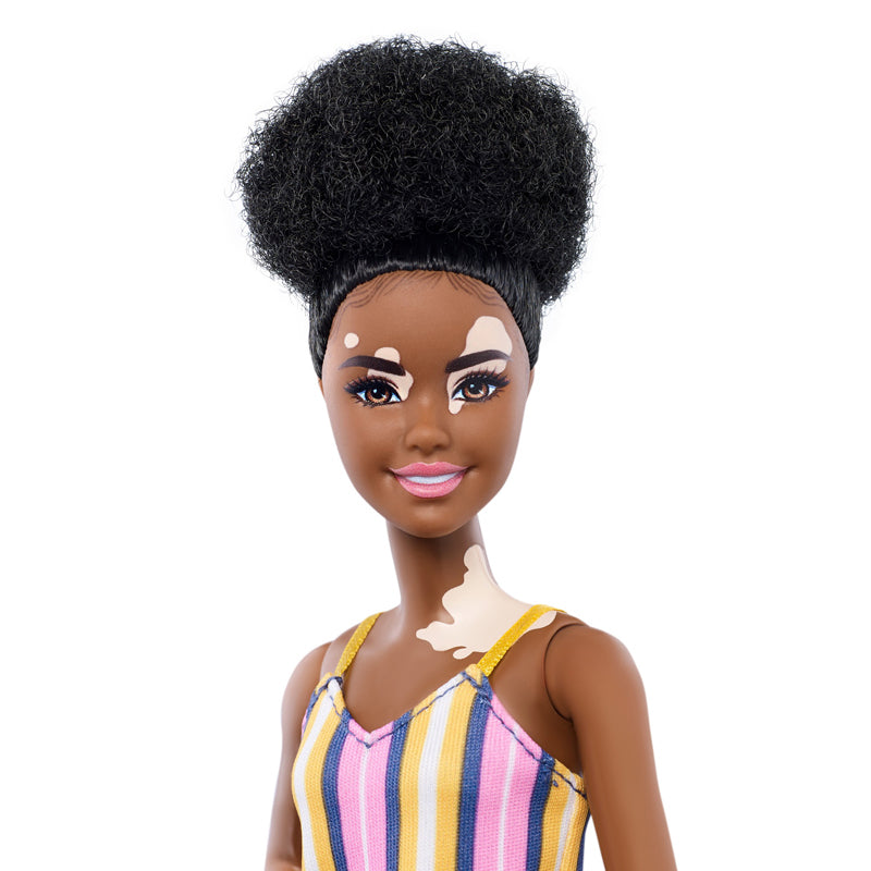 Кукла Barbie Fashionistas Витилиго Mattel