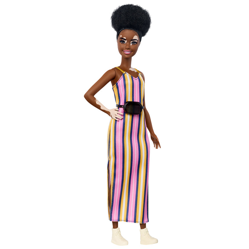 Barbie Fashionistas baba – vitiligo, Mattel